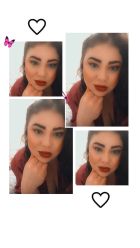 ГОРЛОВОЙ АНАЛ, 8 995 022-83-10